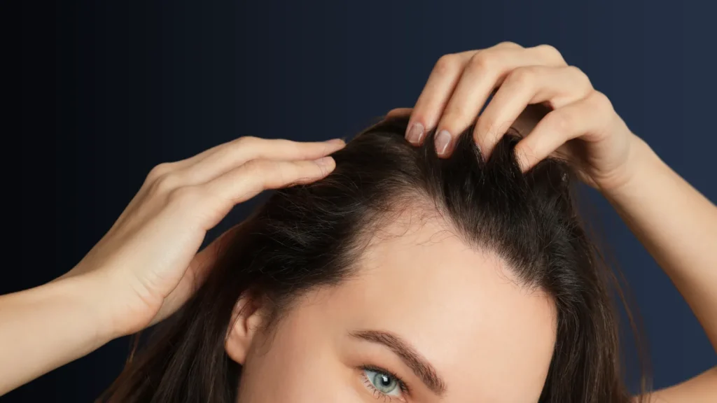 Weibliche Haartransplantation